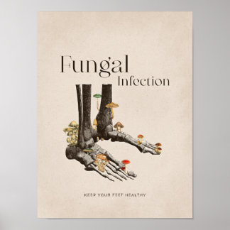 Poster Vintage Infecção Fúngica Pé