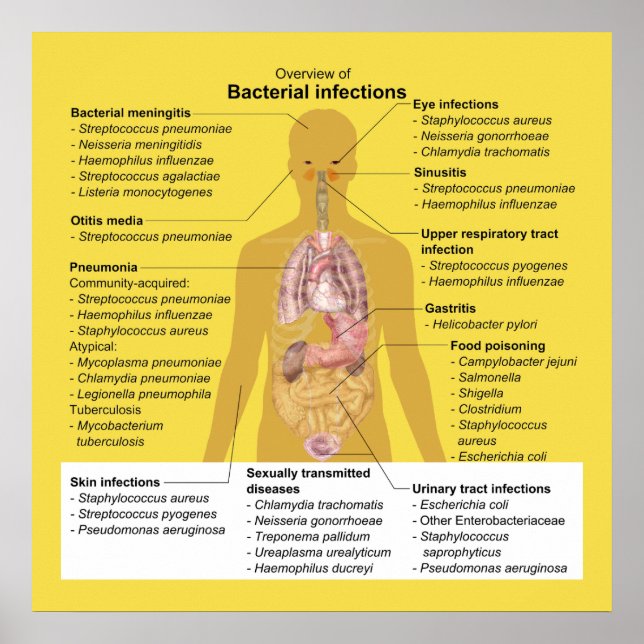 Póster Visão geral das infecções bacterianas (Frente)