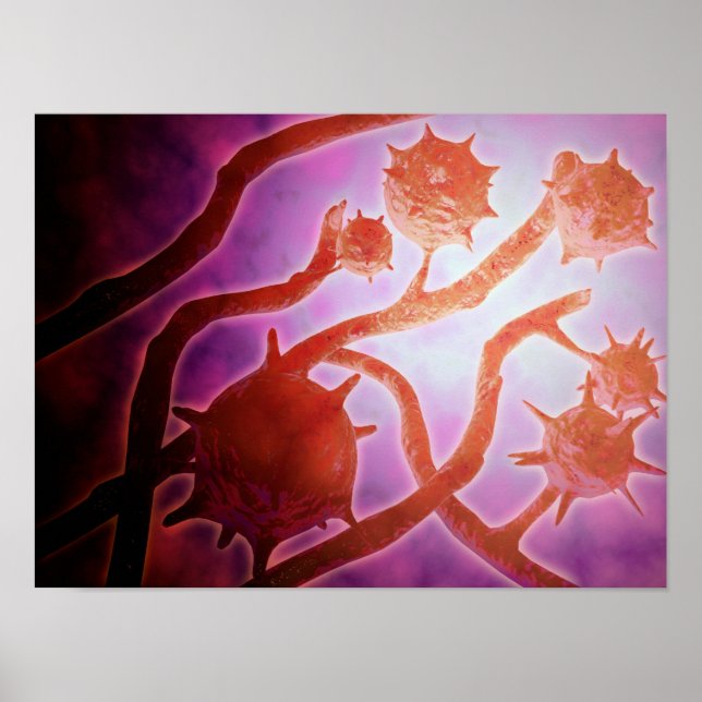 Póster Visão Microscópica Da Histoplasmose (Frente)