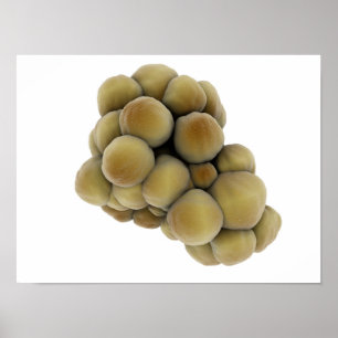 Poster Visão Microscópica Do Tumor 5