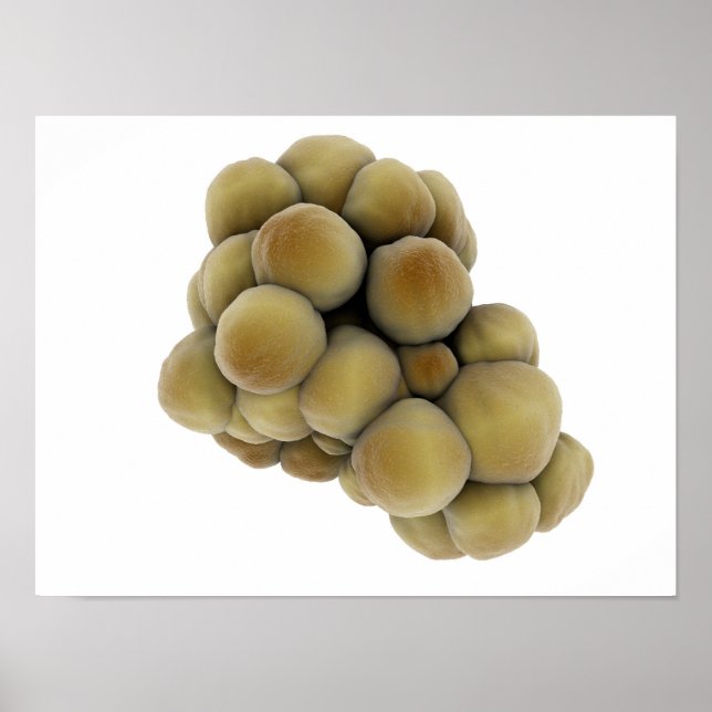 Poster Visão Microscópica Do Tumor 5 (Frente)