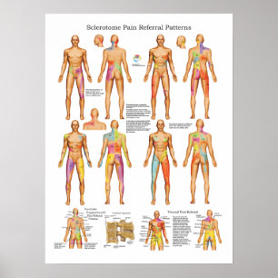 Poster visceral da referência da dor de Sclerotom