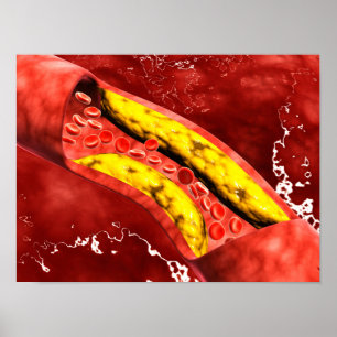 Póster Vista microscópica da chapa gorda dentro da