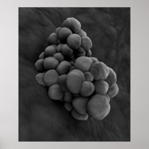 Póster Vista microscópica do tumor 1