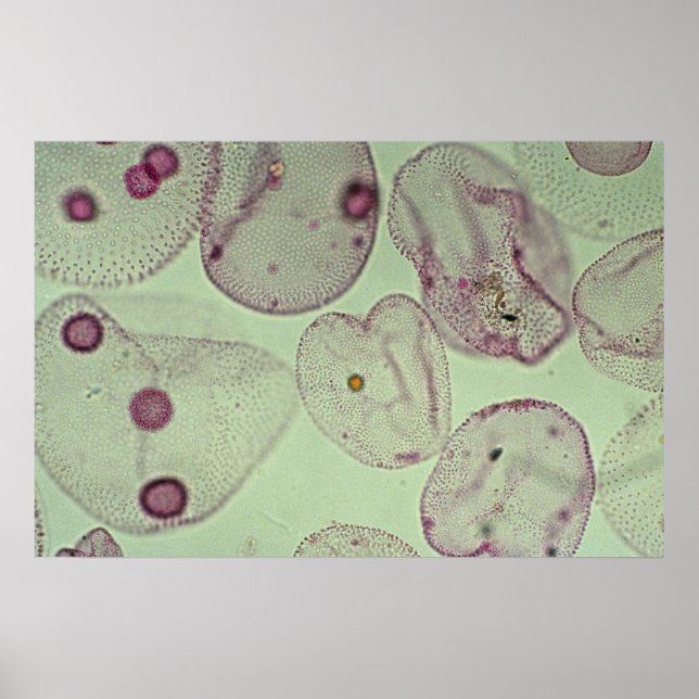 Poster Volvox, algas (Frente)