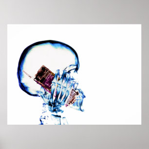 Poster X-Ray Colorido Visão Skeleton Celular