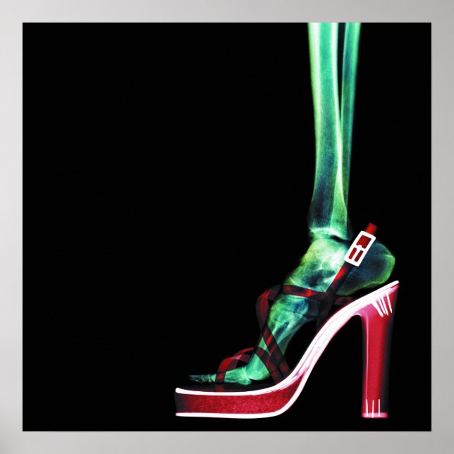 POSTER XRAY HEEL LADY SKELETON FOOT ORIGINAL (Frente)