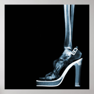 POSTER XRAY HIGH HEEL LADY SKELETON FOOT  BLUE