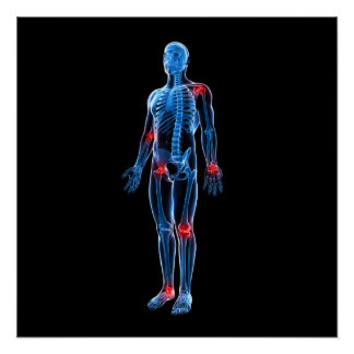 Póster Xray humano