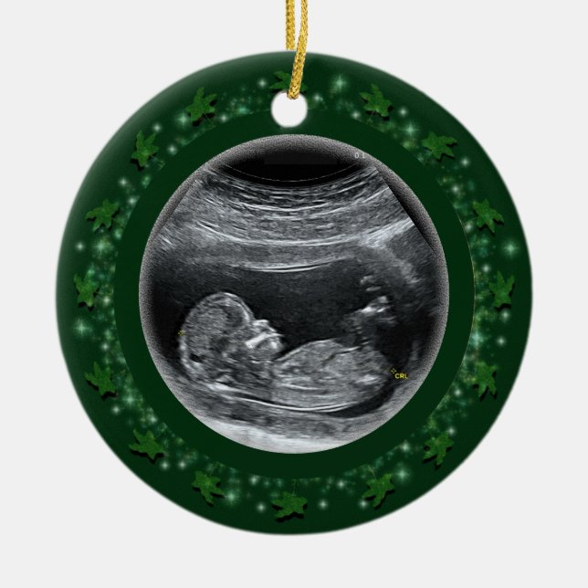 Primeiro Natal do Bebê Ornamento de Cerâmica (Frente)