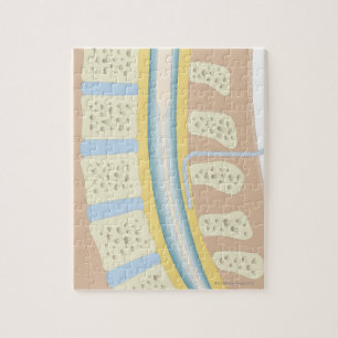 Quebra-cabeça Anestesia Epidural