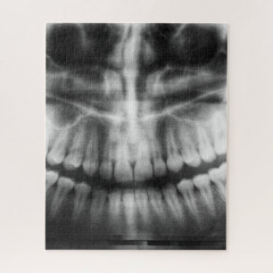Quebra-cabeça Dentes de Raio X Sorriem Preto e Branco