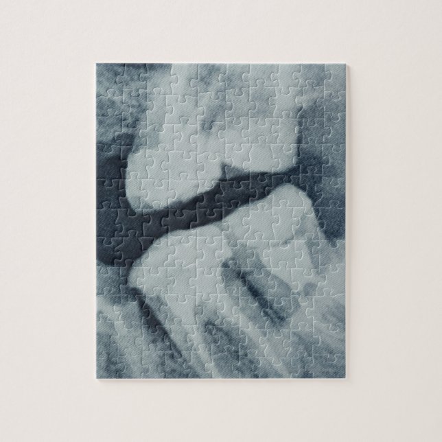 Quebra-cabeça Fechamento de Raio-X dentário (Vertical)