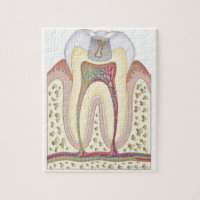 Ilustração do Decaimento dos Dentes