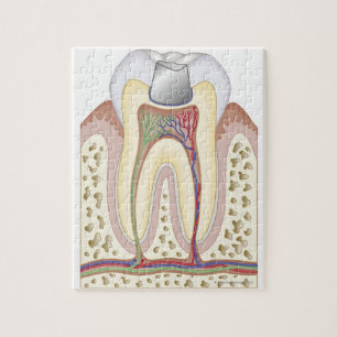 Quebra-cabeça Ilustração do enchimento dental