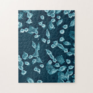 Quebra-cabeça mitotic Blebby da pilha