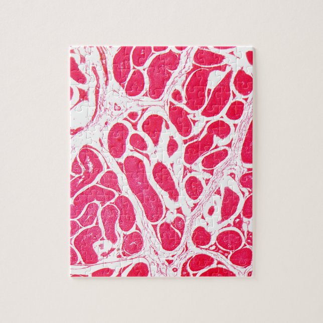 Quebra-cabeça Pilhas do testículo sob o microscópio (Vertical)