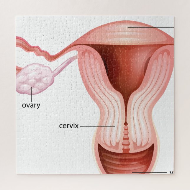 Quebra-cabeça Sistema redutor feminino (Vertical)