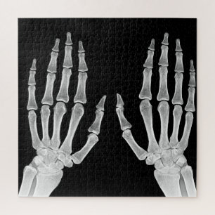 Quebra-cabeça Skeleton Hands Xray Imagem da Anatomia Humana
