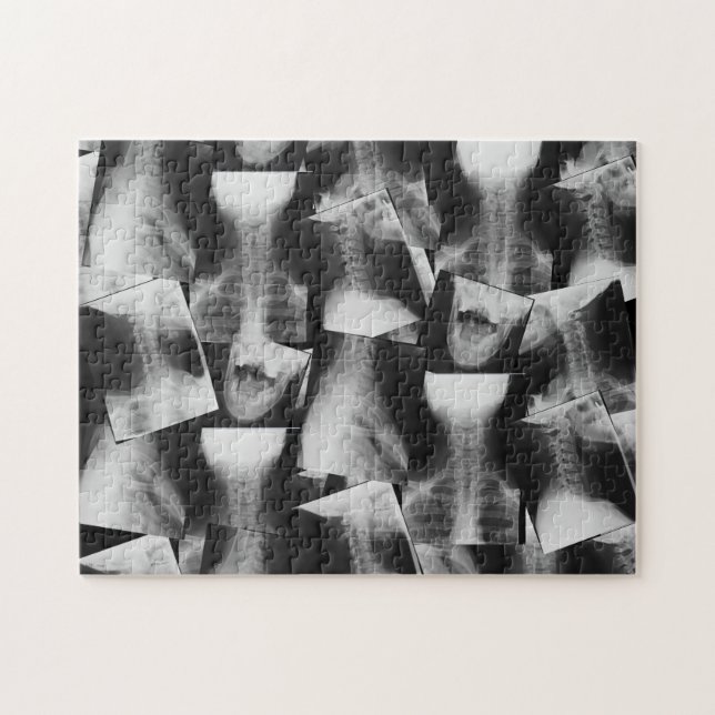 Quebra-cabeça X-Rayed (Original) (Horizontal)