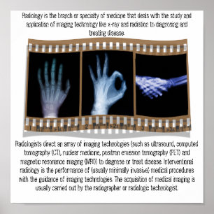 RADIOLOGIA - POSTER DO RAIO X - MÃO, APROVAÇÃO,