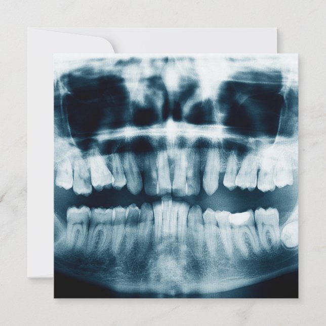 Raio-X dos dentes (Frente)