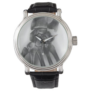 Relógio De Pulso Pulso normal, raio-X