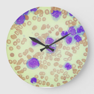 Relógio Grande RBCs WBCs Slide Microscope Hematology Lab