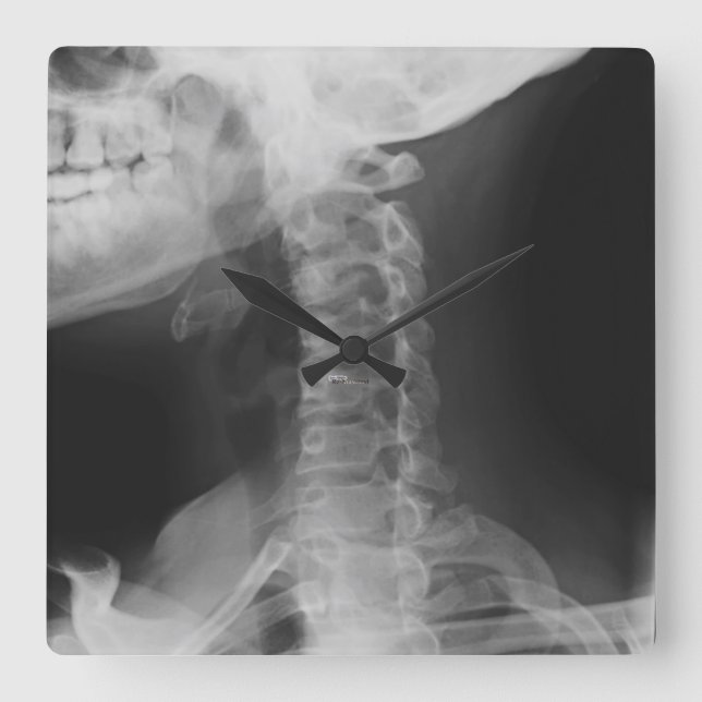 Relógio Quadrado 2 radiografados (Frente)