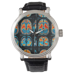 Relógio ressonância magnética cerebral