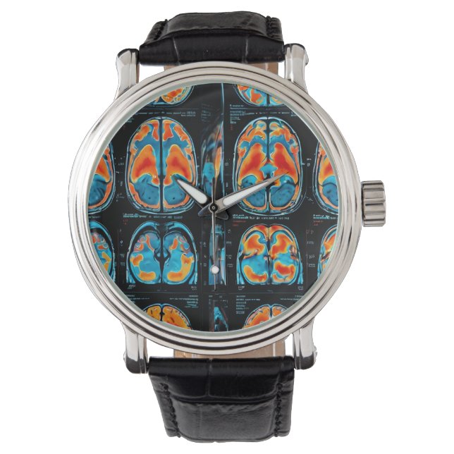 Relógio ressonância magnética cerebral (Frente)