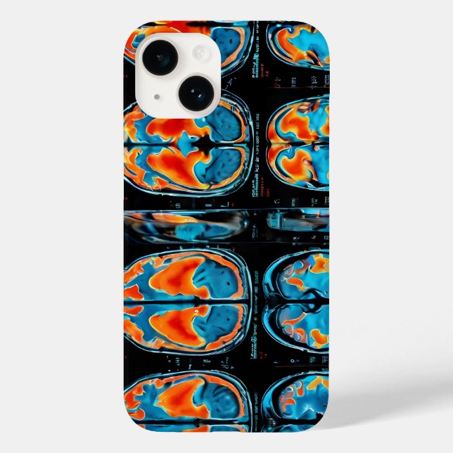 ressonância magnética cerebral (Verso)
