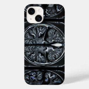 ressonância magnética cerebral