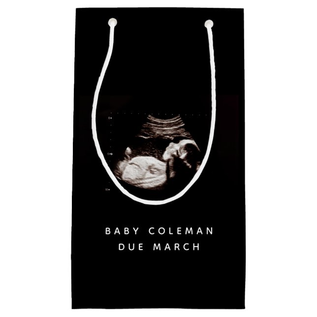 Sacola Para Presentes Pequena Gravidez Sonograma Ultrassom Foto (Frente)