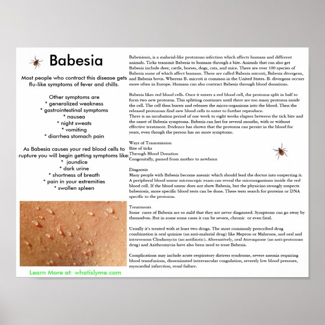 Sintomas Babesia e Poster de Transmissão (Frente)