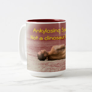 Spondylitis Ankylosing, não uma caneca do