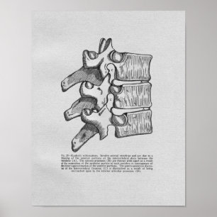 Subluxação Chiropracática Impressão de Vintagem