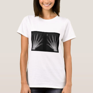 T-shirt X-ray digital extra para a direita e esquerda