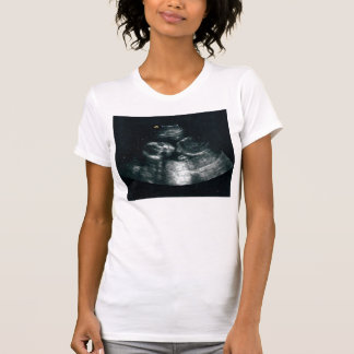 T-shirts Bebê para dentro