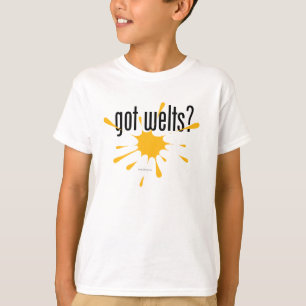 T-shirts O Paintball obteve equimoses?