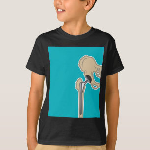 T-shirts Substituição da articulação da bacia