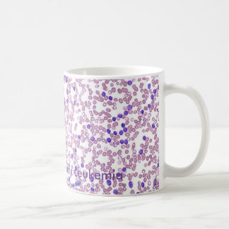 Teste padrão do sangue da caneca de café CLL