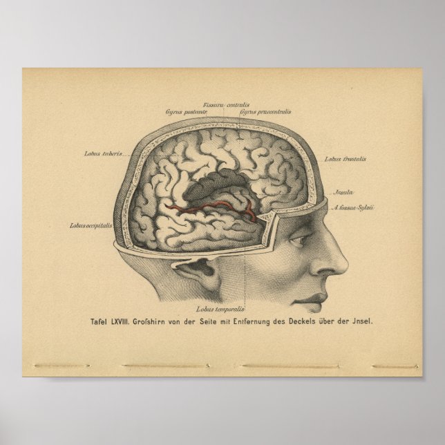 Vintage 1888 Anatomy Impressão Skull Brain (Frente)