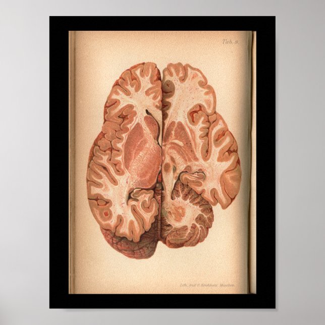 Vintage 1901 Impressão de Anatomia cerebral (Frente)