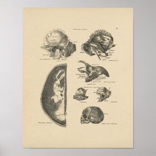 Vintage Human Skull Bones 1880 Impressão